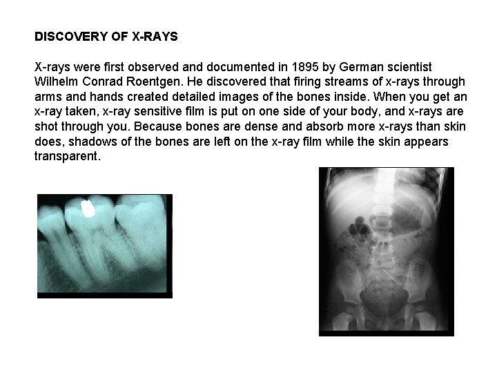 DISCOVERY OF X-RAYS X-rays were first observed and documented in 1895 by German scientist