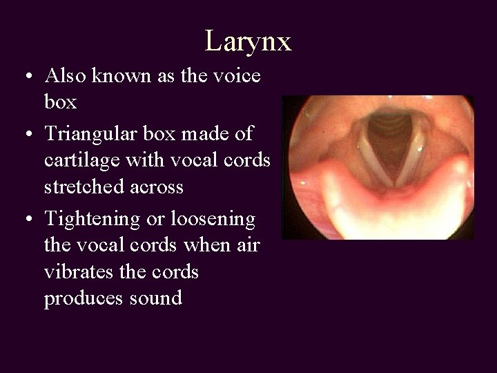 Larynx • Also known as the voice box • Triangular box made of cartilage
