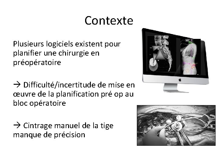 Contexte Plusieurs logiciels existent pour planifier une chirurgie en préopératoire Difficulté/incertitude de mise en