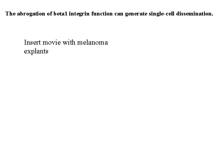 The abrogation of beta 1 integrin function can generate single-cell dissemination. Insert movie with