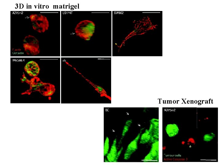 3 D in vitro matrigel Tumor Xenograft 