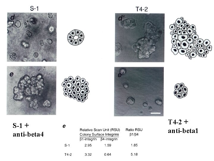 S-1 + anti-beta 4 T 4 -2 + anti-beta 1 