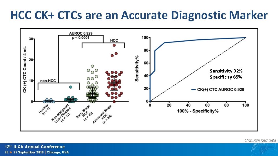 HCC CK+ CTCs are an Accurate Diagnostic Marker Sensitivity 92% Specificity 85% Unpublished data
