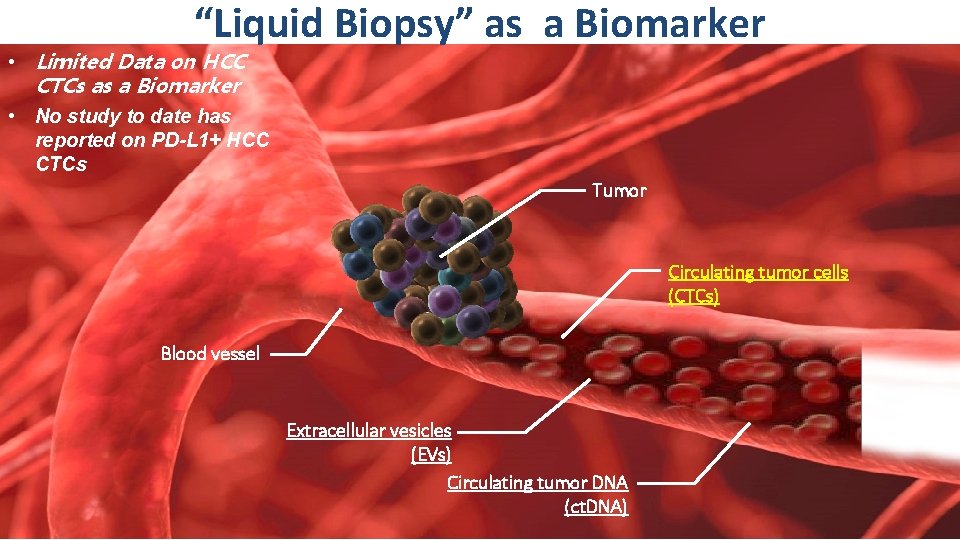 “Liquid Biopsy” as a Biomarker • Limited Data on HCC CTCs as a Biomarker