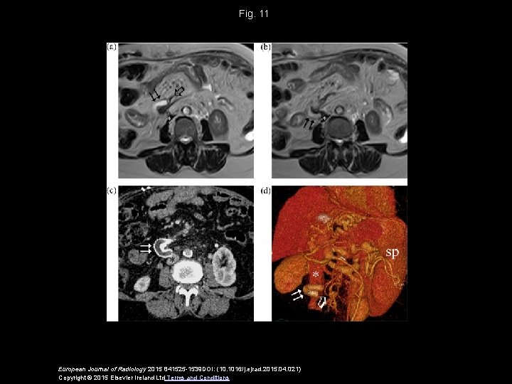 Fig. 11 European Journal of Radiology 2015 841525 -1539 DOI: (10. 1016/j. ejrad. 2015.