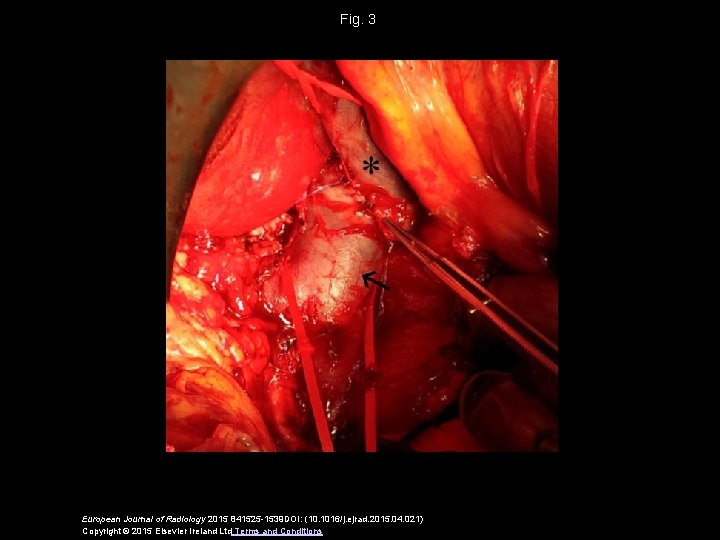 Fig. 3 European Journal of Radiology 2015 841525 -1539 DOI: (10. 1016/j. ejrad. 2015.