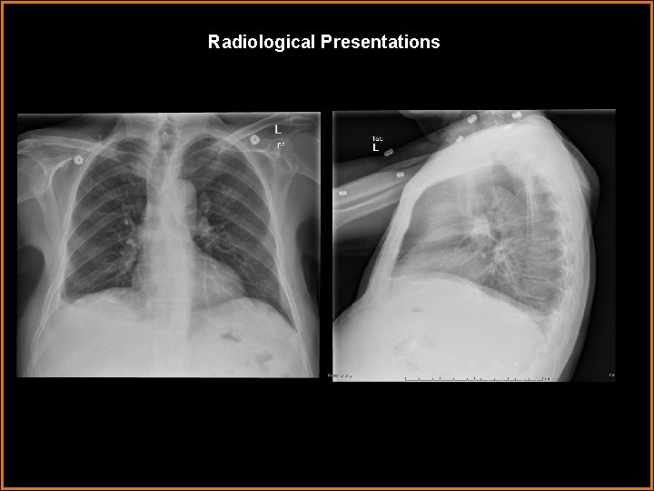 Radiological Presentations 