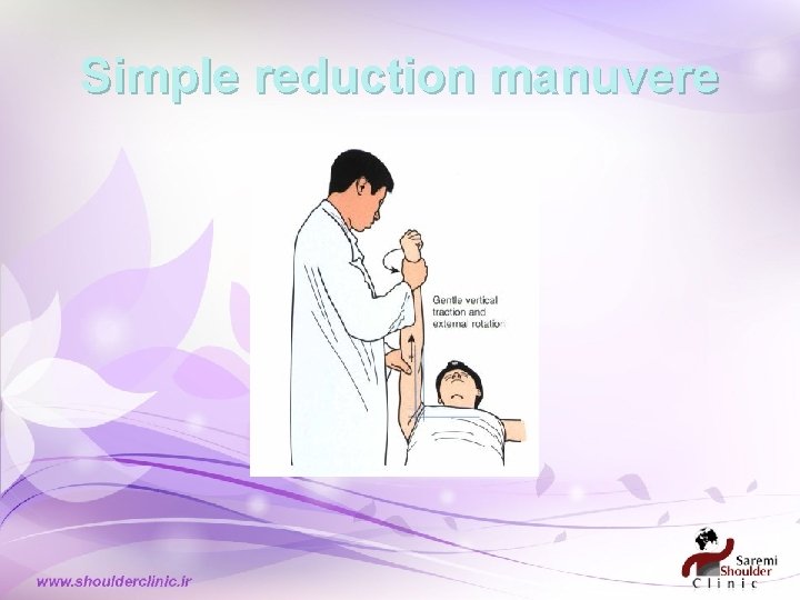 Simple reduction manuvere Simple reduction manuvere