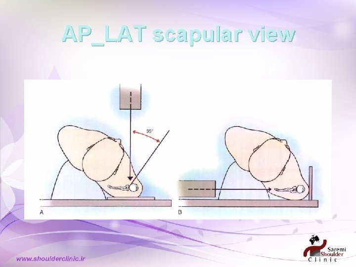 AP_LAT scapular view AP_LAT scapular view