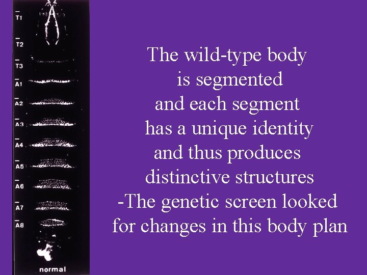 The wild-type body is segmented and each segment has a unique identity and thus