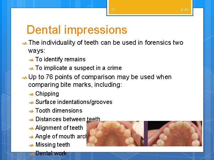 32 of 40 Dental impressions The individuality of teeth can be used in forensics