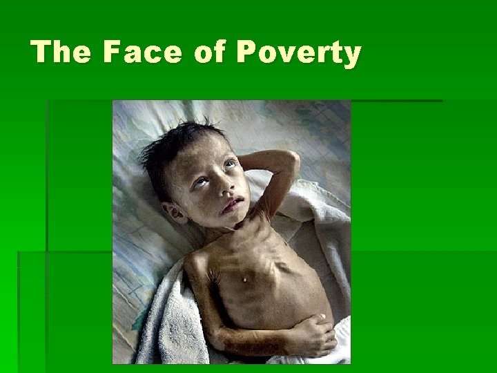 The Face of Poverty 