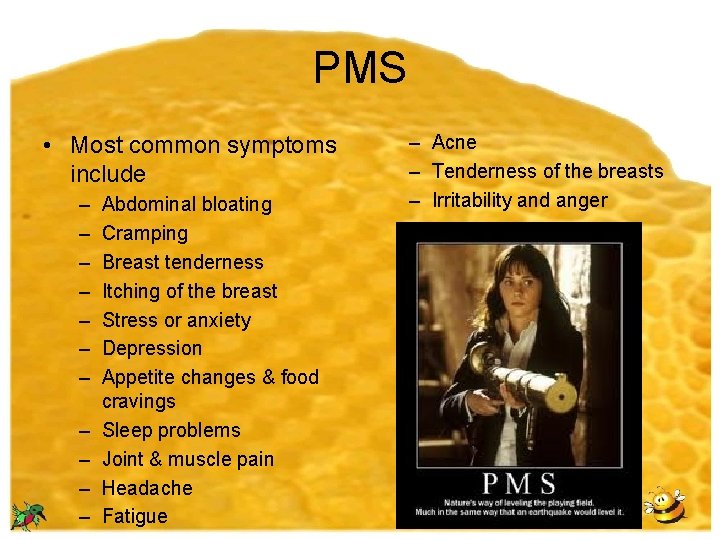PMS • Most common symptoms include – – – Abdominal bloating Cramping Breast tenderness