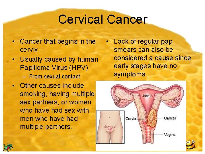 Cervical Cancer • Cancer that begins in the cervix • Usually caused by human