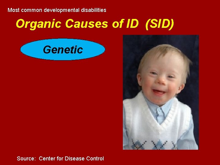 Most common developmental disabilities Organic Causes of ID (SID) Genetic Source: Center for Disease Most common developmental disabilities Organic Causes of ID (SID) Genetic Source: Center for Disease