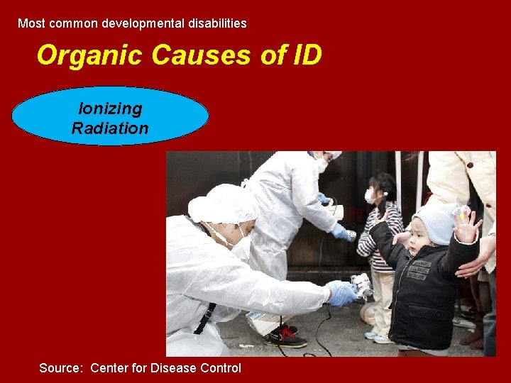 Most common developmental disabilities Organic Causes of ID Ionizing Radiation Source: Center for Disease Most common developmental disabilities Organic Causes of ID Ionizing Radiation Source: Center for Disease