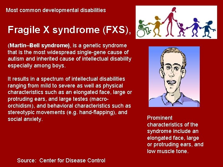 Most common developmental disabilities Fragile X syndrome (FXS), (Martin–Bell syndrome), is a genetic syndrome Most common developmental disabilities Fragile X syndrome (FXS), (Martin–Bell syndrome), is a genetic syndrome