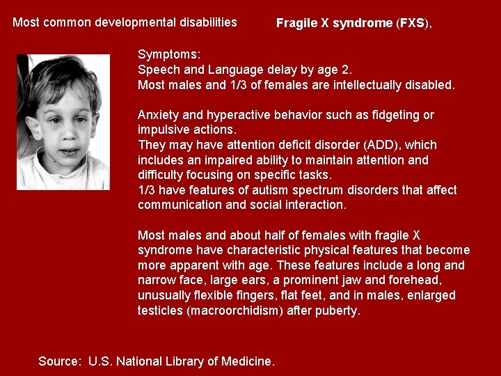 Most common developmental disabilities Fragile X syndrome (FXS), Symptoms: Speech and Language delay by Most common developmental disabilities Fragile X syndrome (FXS), Symptoms: Speech and Language delay by