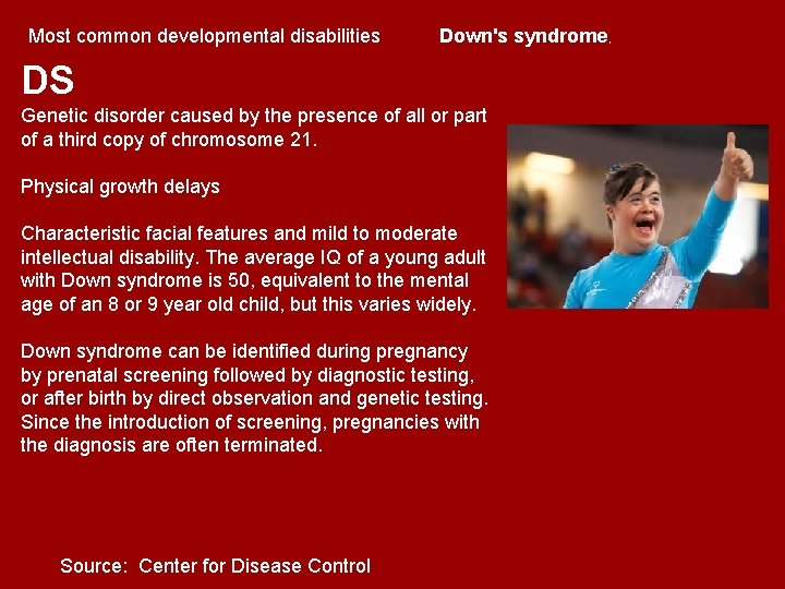 Most common developmental disabilities Down's syndrome, DS Genetic disorder caused by the presence of Most common developmental disabilities Down's syndrome, DS Genetic disorder caused by the presence of