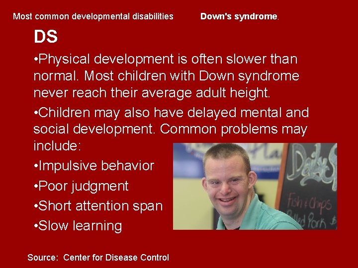 Most common developmental disabilities Down's syndrome, DS • Physical development is often slower than Most common developmental disabilities Down's syndrome, DS • Physical development is often slower than