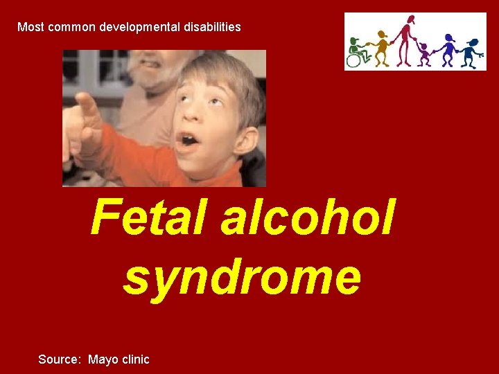 Most common developmental disabilities Fetal alcohol syndrome Source: Mayo clinic Most common developmental disabilities Fetal alcohol syndrome Source: Mayo clinic