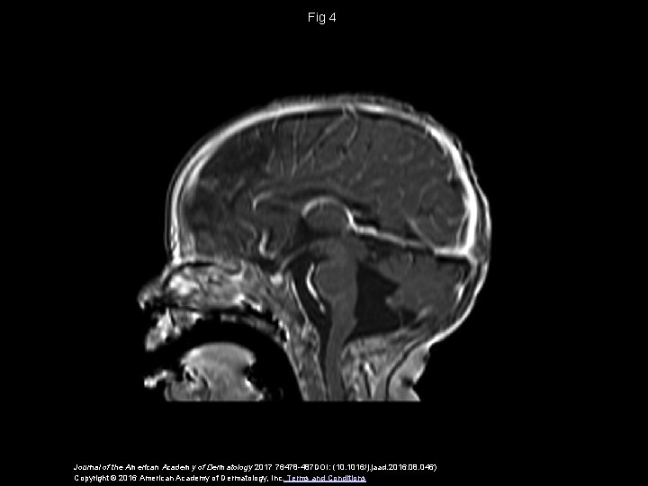 Fig 4 Journal of the American Academy of Dermatology 2017 76478 -487 DOI: (10.