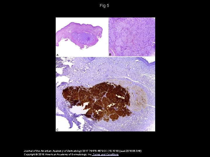 Fig 5 Journal of the American Academy of Dermatology 2017 76478 -487 DOI: (10.