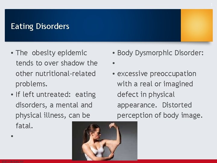 1 Eating Disorders • The obesity epidemic tends to over shadow the other nutritional-related