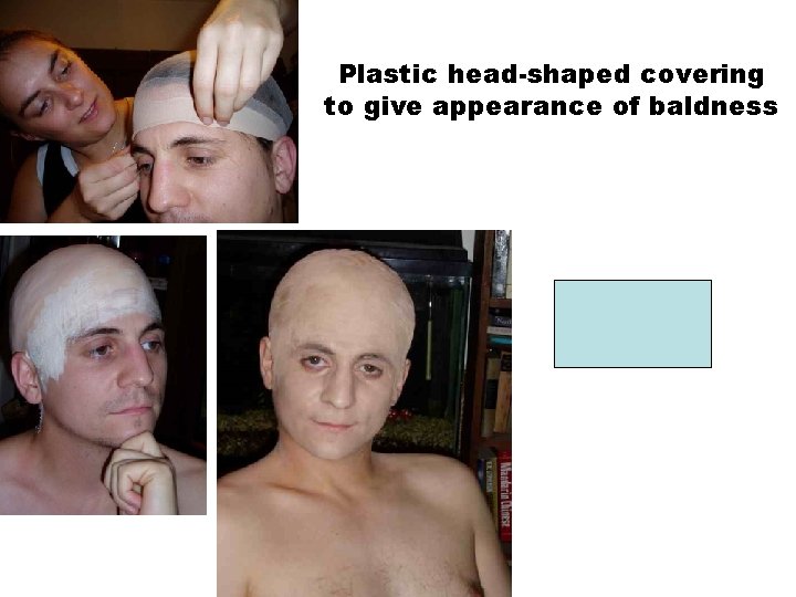 Plastic head-shaped covering to give appearance of baldness SKULL CAP 