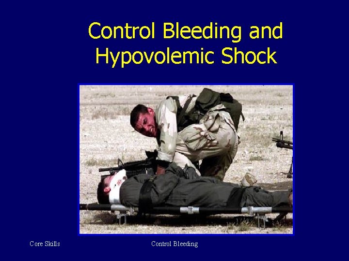 Control Bleeding and Hypovolemic Shock Core Skills Control Bleeding 