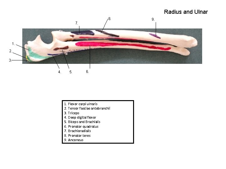 Radius and Ulnar 8. 7. 1. 2. 3. 4. 5. 6. 1. Flexor carpi