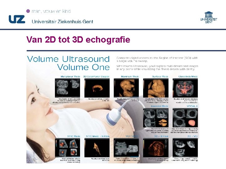 Van 2 D tot 3 D echografie 12 