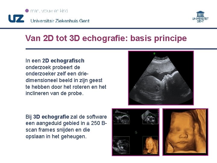 Van 2 D tot 3 D echografie: basis principe In een 2 D echografisch