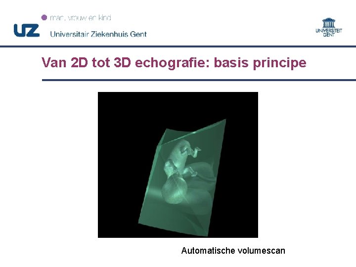 Van 2 D tot 3 D echografie: basis principe Automatische volumescan 14 