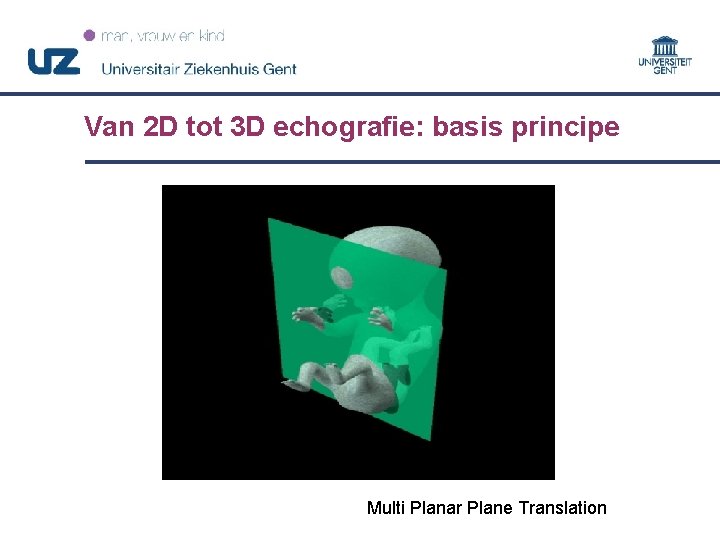 Van 2 D tot 3 D echografie: basis principe Multi Planar Plane Translation 15