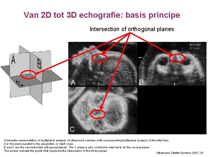 Van 2 D tot 3 D echografie: basis principe Intersection of orthogonal planes A