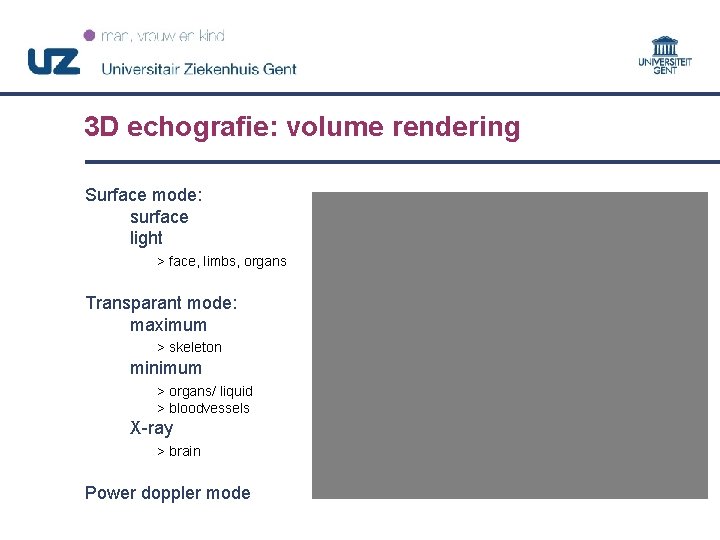 3 D echografie: volume rendering Surface mode: surface light > face, limbs, organs Transparant