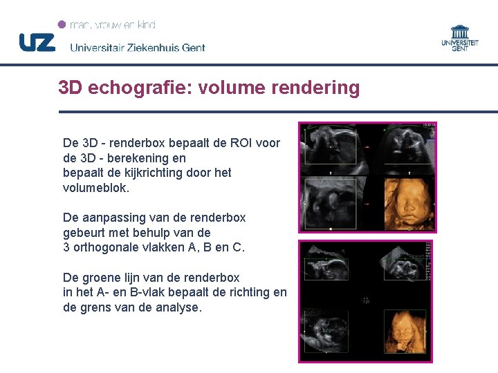 3 D echografie: volume rendering De 3 D - renderbox bepaalt de ROI voor