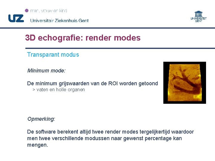 3 D echografie: render modes Transparant modus Minimum mode: De minimum grijswaarden van de