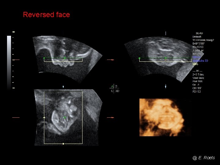 Reversed face @ E. Roets 