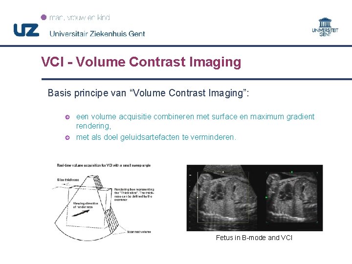 VCI - Volume Contrast Imaging Basis principe van “Volume Contrast Imaging”: een volume acquisitie