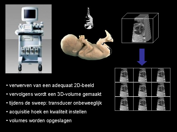  • verwerven van een adequaat 2 D-beeld • vervolgens wordt een 3 D-volume