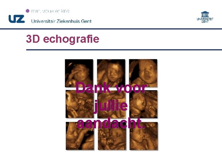 3 D echografie Dank voor jullie aandacht. 69 