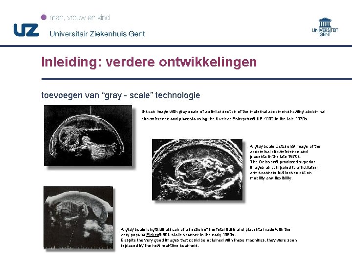 Inleiding: verdere ontwikkelingen toevoegen van “gray - scale” technologie B-scan image with gray scale