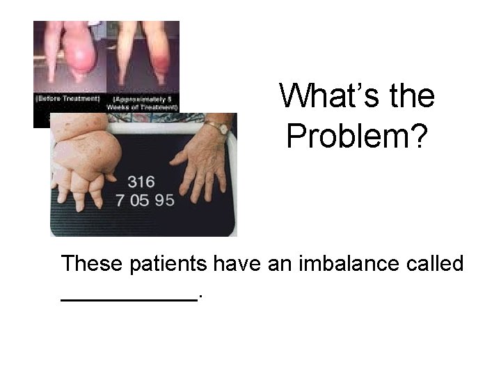 What’s the Problem? These patients have an imbalance called ______. 