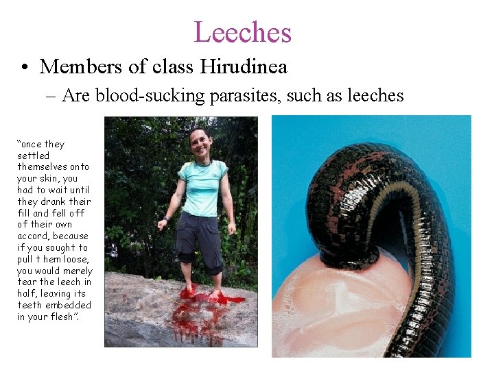 Leeches • Members of class Hirudinea – Are blood-sucking parasites, such as leeches “once