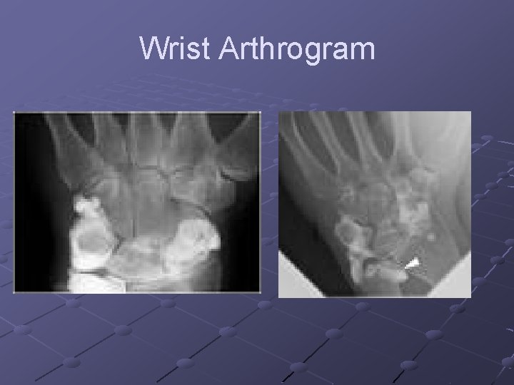 Arthrography Spring 2011 Final Arthrography Used to obtain