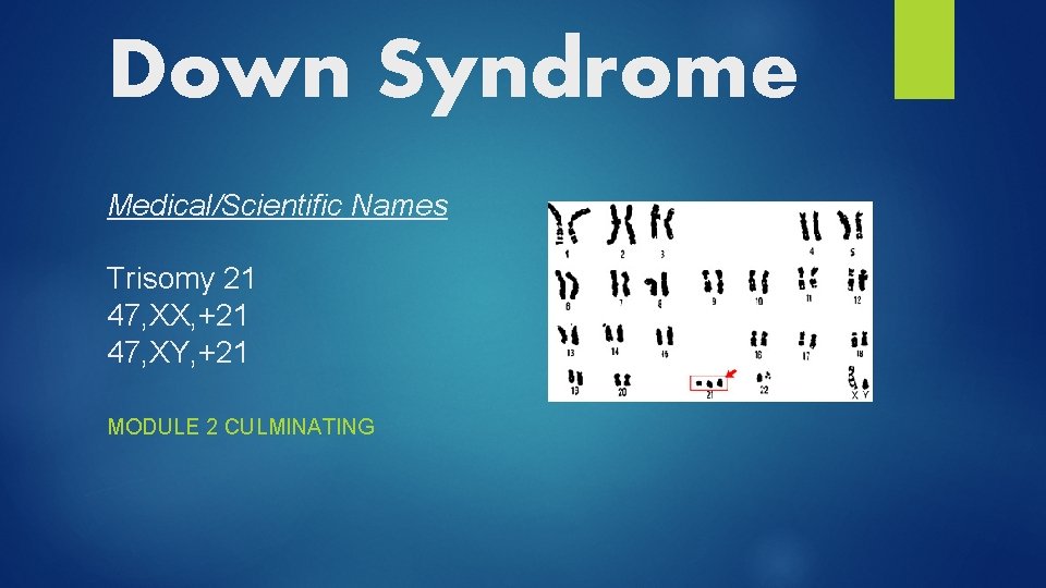Down Syndrome Medical/Scientific Names Trisomy 21 47, XX, +21 47, XY, +21 MODULE 2
