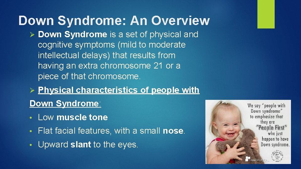 Down Syndrome: An Overview Ø Down Syndrome is a set of physical and cognitive