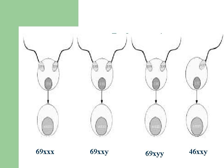 Pathogenesis 69 xxx 69 xxy 69 xyy 46 xxy 